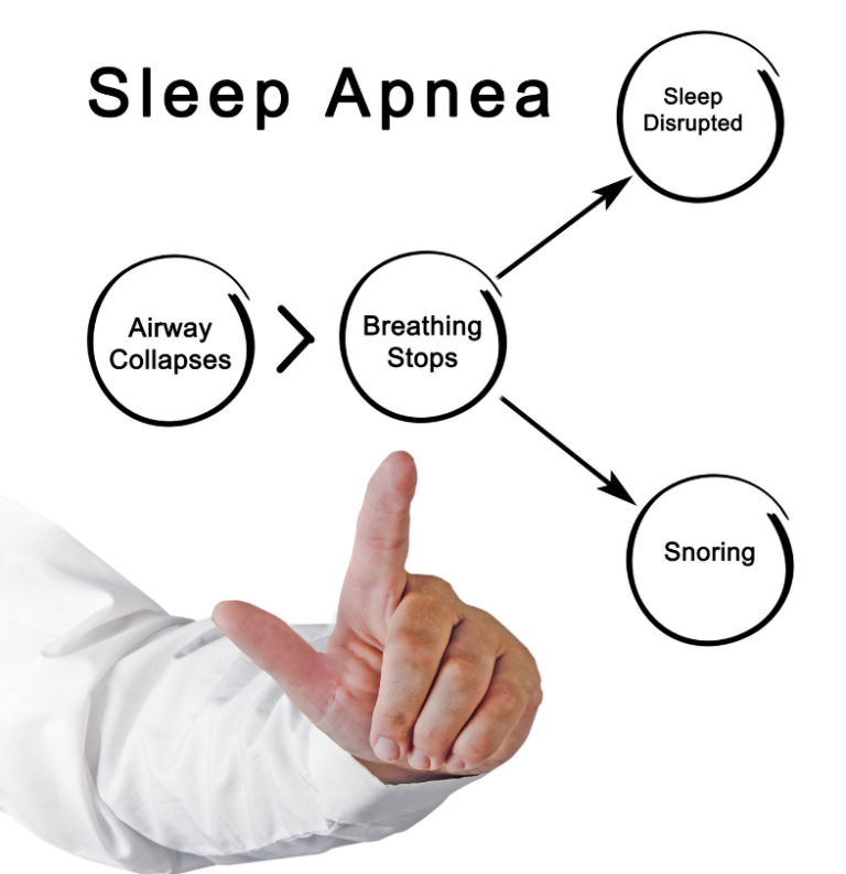 Sleep Apnea: A Comprehensive Guide for Seniors to Improve Sleep Quality and Overall Health